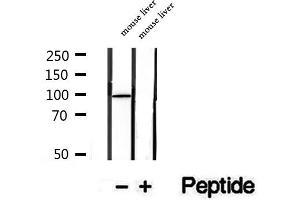 Western Blotting (WB) image for anti-STT3, Subunit of The Oligosaccharyltransferase Complex, Homolog B (STT3B) (C-Term) antibody (ABIN6265353)