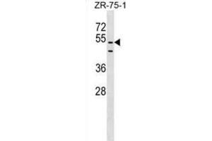 Western Blotting (WB) image for anti-PDZ Domain Containing 3 (PDZD3) antibody (ABIN2999605) (PDZD3 Antikörper)