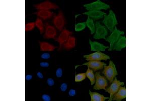 ABIN6258953 and ABIN6276209 staining Hela cells(45 min of heat-shock) by IF/ICC. (QRFPR Antikörper  (Internal Region))