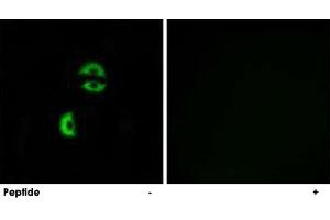 Immunofluorescence analysis of A-549 cells, using LDLRAD3 polyclonal antibody . (LDLRAD3 Antikörper)