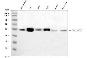 Western blot analysis of NDP52/CALCOCO2 using anti-NDP52/CALCOCO2 antibody (ABIN7599400).