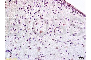 Formalin-fixed and paraffin embedded rat brain tissue labeled withAnti-EPOR Polyclonal Antibody (ABIN686347), Unconjugated at 1:100 followed by conjugation to the secondary antibody, (SP-0023), and DAB staining (EPOR Antikörper  (AA 301-450))
