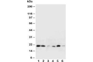 Western blot testing of HSPB2 antibody and Lane 1:  rat liver;  2: rat spleen;  3: human HeLa;  4: (h) COLO320;  5: (h) HT1080;  6: (h) MCF-7 cell lysate