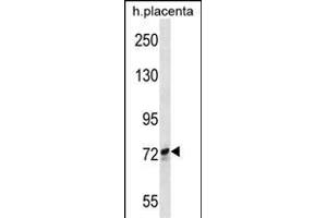 SCYL1 Antibody (N-term) (ABIN652299 and ABIN2841349) western blot analysis in human placenta tissue lysates (35 μg/lane). (SCYL1 Antikörper  (N-Term))