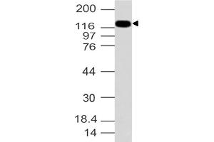 Image no. 1 for anti-Formin-Like 2 (FMNL2) (AA 1-321) antibody (ABIN5027206) (FMNL2 Antikörper  (AA 1-321))