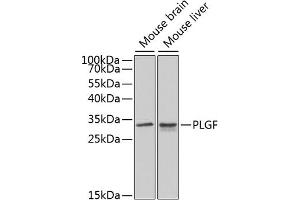 Western blot analysis of extracts of various cell lines, using PLGF antibody (ABIN3015554, ABIN3015555, ABIN3015556 and ABIN6218826) at 1:1000 dilution. (PLGF Antikörper  (AA 19-170))
