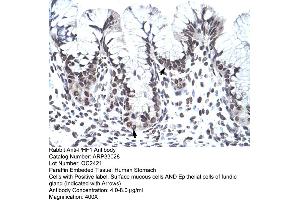 Human Stomach (PHF1 Antikörper  (C-Term))
