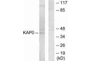 Western blot analysis of extracts from HepG2 cells, using KAP0 antibody. (PRKAR1A Antikörper  (N-Term))