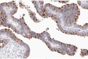 ABIN6267583 at 1/200 staining human Fallopian tube tissue sections by IHC-P.