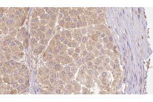 ABIN6273781 at 1/100 staining Human Melanoma tissue by IHC-P. (FGF19 Antikörper  (C-Term))