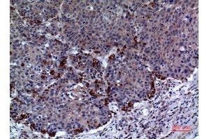 Immunohistochemistry (IHC) analysis of paraffin-embedded Human Lung, antibody was diluted at 1:100. (Periaxin Antikörper  (Internal Region))