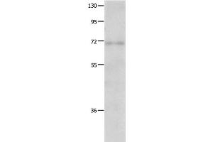 Western Blot analysis of Human fetal lung tissue using IGF2BP1 Polyclonal Antibody at dilution of 1:500 (IGF2BP1 Antikörper)