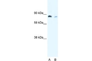 WB Suggested Anti-NFKB2 Antibody Titration:  0. (NFKB2 Antikörper  (N-Term))