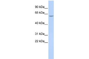 WB Suggested Anti-CES7 Antibody Titration:  0. (CES5A Antikörper  (Middle Region))