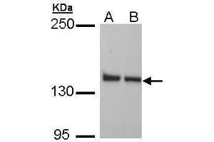 WB Image Sample (30 ug of whole cell lysate) A: H1299 B: HeLa 5% SDS PAGE antibody diluted at 1:1000 (LRPPRC Antikörper)