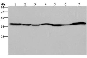 Western Blot analysis of 293T and Hela cell, Human fetal liver, Mouse spleen and heart tissue, Human fetal brain and hepatocellular carcinoma tissue using GOT2 Polyclonal Antibody at dilution of 1:400 (GOT2 Antikörper)