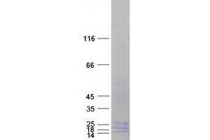 Validation with Western Blot (LY96 Protein (Transcript Variant 2) (Myc-DYKDDDDK Tag))