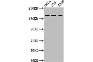 Western Blot Positive WB detected in: Hela whole cell lysate, 293 whole cell lysate, A549 whole cell lysate All lanes: CDON antibody at 3. (CDON Antikörper  (AA 1095-1211))
