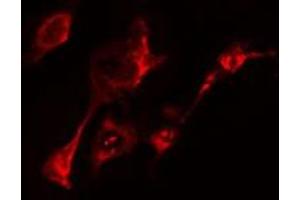 ABIN6275460 staining  HeLa cells by IF/ICC. (RAB20 Antikörper  (Internal Region))