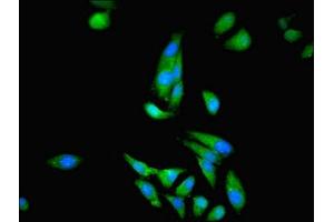 Immunofluorescent analysis of Hela cells using ABIN7148658 at dilution of 1:100 and Alexa Fluor 488-congugated AffiniPure Goat Anti-Rabbit IgG(H+L) (CKB Antikörper  (AA 2-270))