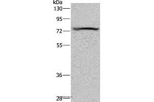 Western blot analysis of Mouse heart tissue, using KCNQ1 Polyclonal Antibody at dilution of 1:200 (KCNQ1 Antikörper)