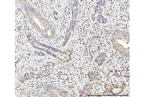 IHC analysis of MOV10 using anti-MOV10 antibody (ABIN7600236). (MOV10 Antikörper  (AA 167-772))