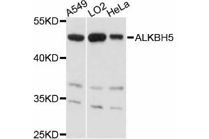Western blot analysis of extracts of various cell lines, using ALKBH5 antibody (ABIN4902897) at 1:3000 dilution. (ALKBH5 Antikörper)