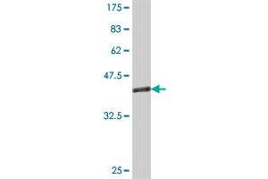 Western Blot detection against Immunogen (35. (RGS5 Antikörper  (AA 94-181))