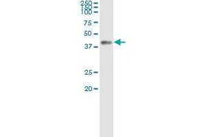 ACAT2 (Human) IP-WB Antibody Pair