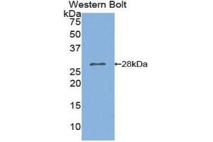 Western Blotting (WB) image for anti-Phospholipase A2, Group VI (Cytosolic, Calcium-Independent) (PLA2G6) (AA 481-702) antibody (ABIN1859465) (PLA2G6 Antikörper  (AA 481-702))