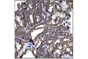 IHC analysis of Caspase-9/CASP9 using anti-Caspase-9/CASP9 antibody (ABIN7600340). (Caspase 9 Antikörper  (AA 18-416))