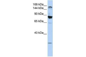 TJP2 antibody used at 1 ug/ml to detect target protein. (TJP2 Antikörper)