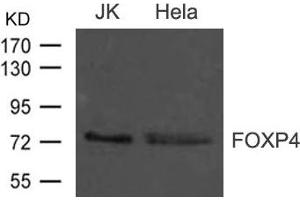 Western blot analysis of extract from JK and Hela cells using FOXP4 Antibody (FOXP4 Antikörper)