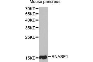 Western Blotting (WB) image for anti-Ribonuclease, RNase A Family, 1 (Pancreatic) (RNASE1) antibody (ABIN1882329) (RNASE1 Antikörper)