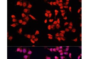 Immunofluorescence analysis of HeLa cells using YBX1 Polyclonal Antibody at dilution of 1:100. (YBX1 Antikörper)