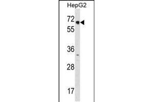 Western Blotting (WB) image for anti-Nuclear Receptor Subfamily 2, Group C, Member 1 (NR2C1) (AA 516-545), (C-Term) antibody (ABIN5531754)
