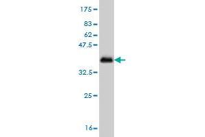 Western Blot detection against Immunogen (36. (CSNK1G1 Antikörper  (AA 293-393))