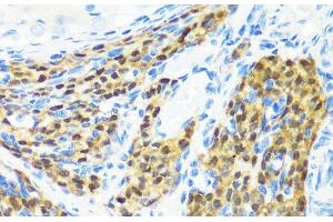 Immunohistochemistry of paraffin-embedded Rat ovary using KMT2E Polyclonal Antibody at dilution of 1:200 (40x lens). (MLL5/KMT2E Antikörper)