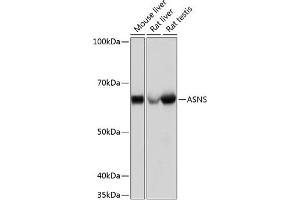 Western blot analysis of extracts of various cell lines, using ASNS Rabbit mAb (ABIN7265692) at 1:1000 dilution. (Asparagine Synthetase Antikörper)