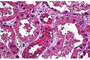 Human Kidney: Formalin-Fixed, Paraffin-Embedded (FFPE) (ERBB3 Antikörper  (AA 1-131))