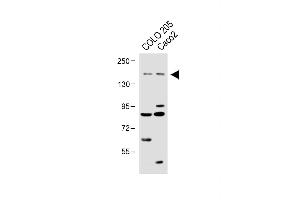 All lanes : Anti-TNIK Antibody at 1:1000 dilution Lane 1: COLO 205 whole cell lysate Lane 2:Caco2 whole cell lysate Lysates/proteins at 20 μg per lane.