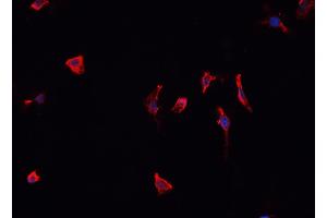 Immunofluorescence (fixed cells) (IF/ICC) image for anti-Caspase Recruitment Domain Family, Member 6 (CARD6) (N-Term) antibody (ABIN6260460)