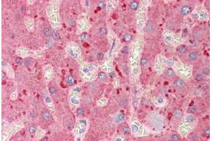 Human Liver (formalin-fixed, paraffin-embedded) stained with A2M antibody ABIN291670 at 2. (alpha 2 Macroglobulin Antikörper)