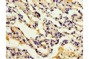Immunohistochemistry of paraffin-embedded human lung tissue using ABIN7150056 at dilution of 1:100 (ADAM33 Antikörper  (AA 140-420))