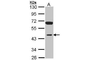 WB Image Sample (30 ug of whole cell lysate) A: Raji 10% SDS PAGE antibody diluted at 1:1000 (INPP1 Antikörper)