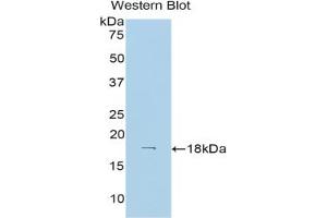 Western blot analysis of the recombinant protein. (Hexokinase 1 Antikörper  (AA 137-270))