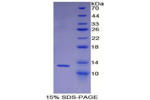 SDS-PAGE analysis of Mouse BRAK Protein. (CXCL14 Protein)
