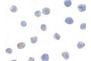 Immunocytochemistry of IKK alpha in Jurkat cells with AP30403PU-N IKK alpha antibody at 1μg/ml. (IKK alpha Antikörper  (C-Term))