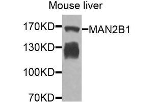 Western blot analysis of extracts of mouse liver, using MAN2B1 antibody (ABIN6003645) at 1/1000 dilution. (MAN2B1 Antikörper)