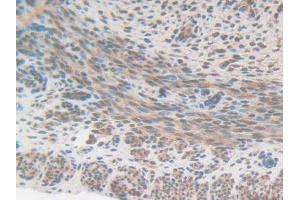 IHC-P analysis of Mouse Uterus Tissue, with DAB staining. (CS Antikörper  (AA 174-428))